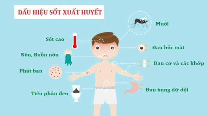 sốt xuất huyết