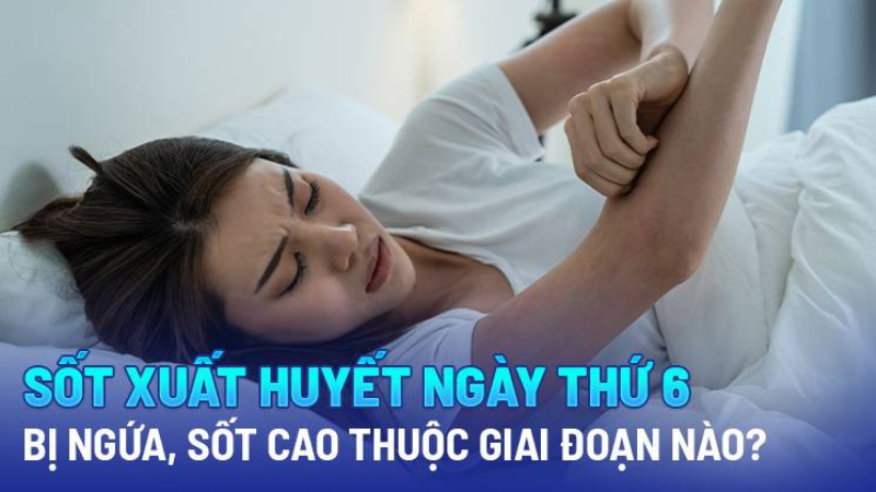 sốt xuất huyết ngày thứ 6